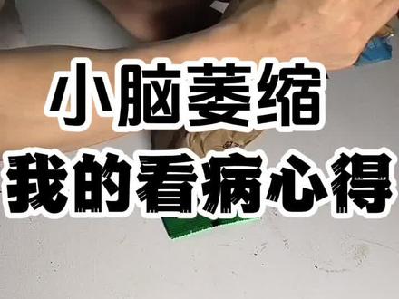 我是患病 8 年的小脑萎缩患者,这次去找医生不是为了治病,只是为了固本培元。调理好身体体质,这也是我这套中西医调理缓解小脑萎缩方法的第一步
#罕见病 #小脑萎缩 #SCA7 #日常锻炼 #生活记录
