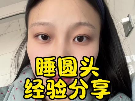想要睡圆头并不一定要用定型枕,侧睡躺睡趴睡交替睡就好,颅顶高的宝宝随着月龄的增大会慢慢降下来,宝宝头型不好看真不用太焦虑#睡圆头 #宝宝头型 #宝妈分享 #睡头型
