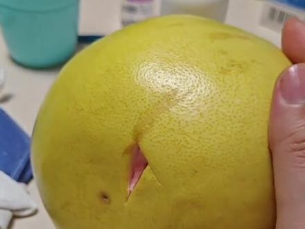 肛瘘手术后上班期间伤口如何处理,肛瘘手术后上班伤口处理,肛瘘上班伤口换药,肛瘘上班需要的换药物品#肛瘘术后上班换药 #肛瘘换药