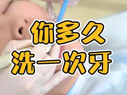 你洗过牙吗?你知道经常不洗牙的人牙齿是什么样的吗?#洗牙 #解压 #口腔健康 #武汉同济医院