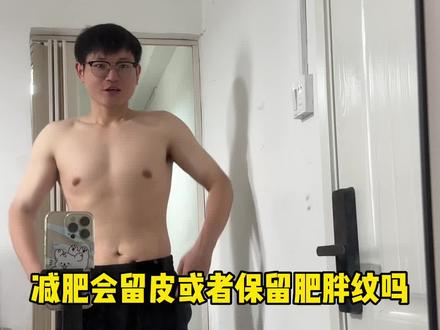 这是一期很真实的记录减肥瘦下来后的皮肤状态!#减肥 #肥胖纹