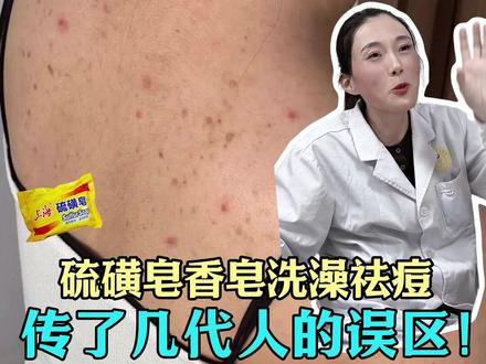 别再硫磺皂祛痘了 老一辈深信不疑的祛痘方法竟然是错的。 #硫磺皂 #祛痘 #护肤误区 #皮肤问题 #医生科普