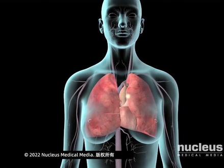 #医学科普 #3d动画演示 #每天持续分享科普知识 #深静脉血栓(DVT)#肺栓塞(PE)@宁夏回族自治区人民医院心脏大血管外科