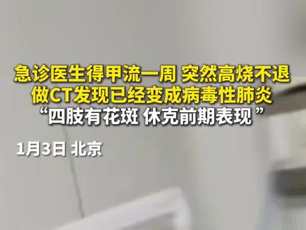 急诊医生得甲流一周 突然高烧不退,做CT发现已经变成病毒性肺炎,“四肢有花斑 休克前期表现”。
