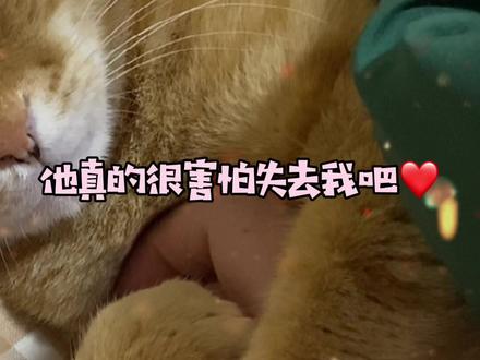 他不会扶我起来,也不会给我递纸巾,他只会一遍遍催促希望听到我的回应,他只会抱紧我的手确认我还在他身边,他真的害怕失去我!