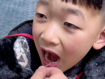 猪鼻扣系绳法拔牙#拔牙记 #人类幼崽成长记 #宝贝换牙