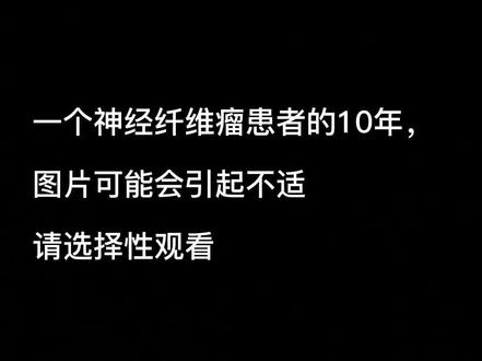 一名神经纤维瘤患者的十年,请选择性观看#神经纤维瘤 #神经纤维瘤患者