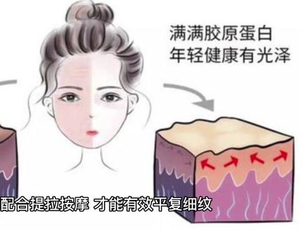 如何区分干纹和细纹#护肤 #皮肤管理 #告别肌肤问题