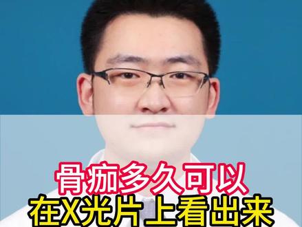 骨痂多久可以在X光片上看出来#北京积水潭医院 #专业健康科普送给咱爸妈 #骨科 #医疗科普 #医院日常