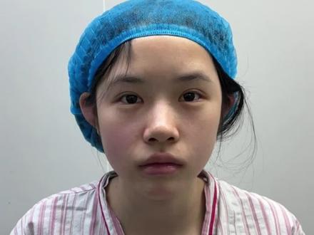 花了26800去做了个鼻子可结果.....#鼻子 #变美 #逆袭 #变美日记 #隆鼻