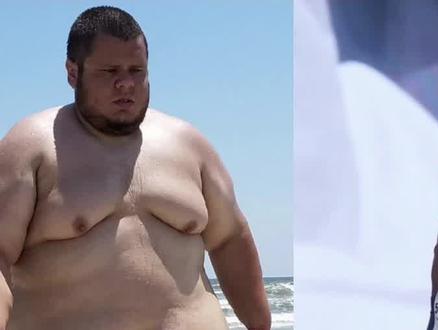 从减掉136公斤到切除皮肤,他经历了什么?#健身房那些事儿 #健身氮泵 #健身 #健身前后的变化 #减肥