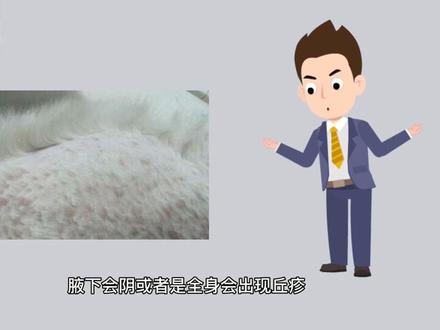 羊痘的基本症状,预防和常规治疗