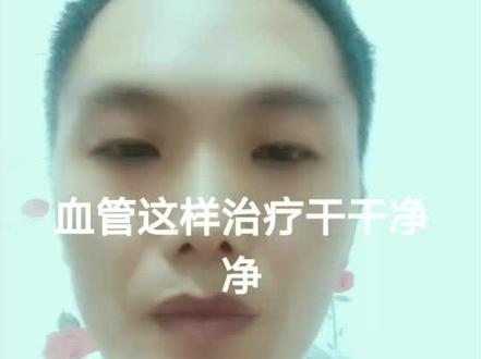 通血管预防治疗心脑血管疾病:一杯苹果醋,一杯柠檬汁,一杯大蒜汁,一杯生姜汁!坚持喝,血管干干净净的!