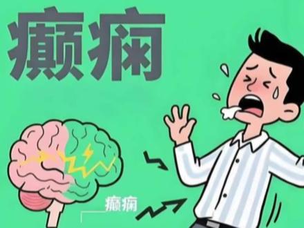 中国iPSC癫痫细胞药物获中美双批,跃赛生物攻克难治性癫痫新疗法#癫痫 #羊癫疯 #医学突破 #科技改变未来