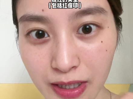 无广干货:脸上跟“红”相关问题一一对应的解决方式~