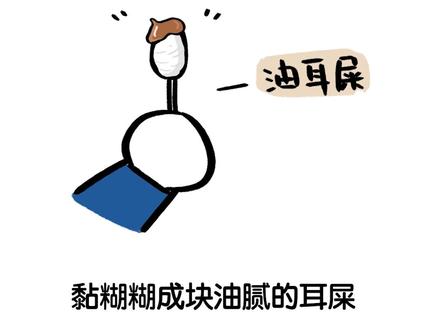 我们的耳朵需要经常掏吗? #冷知识 #挖耳屎 #国庆知识点