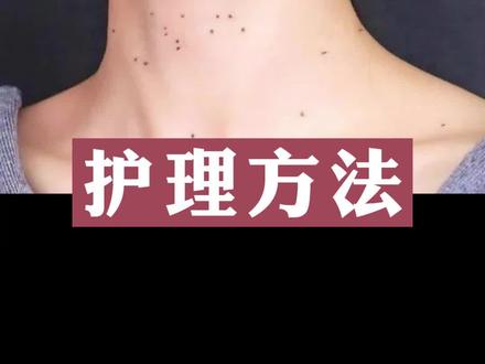 丝状疣处理后,皮肤这样护理。#皮肤健康 #丝状疣 #瘊子肉刺