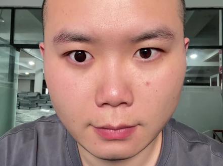 #义眼 #逆袭 给大家分享一下佩戴义眼片的效果!