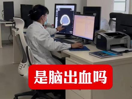 急诊外伤,CT查出高密度影,它是脑出血吗?#急诊#脑出血 #硬核健康科普dou来说 #脑卒中 #医学生