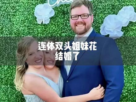 双头连体姐妹花结婚 #连体人 #连体双胞胎 #结婚 #涨见识 #涨知识