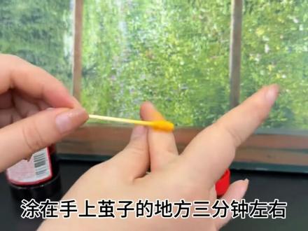 看我七十二变#逆袭#改变#去茧#茧子