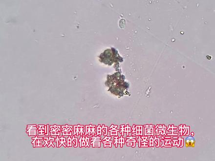 自来水烧到100度后能喝吗?#显微镜 放大1000倍给老铁们看看😱#健康饮水#自来水#开水#微观世界 #内容过于真实@抖音小助手 @DOU+小助手