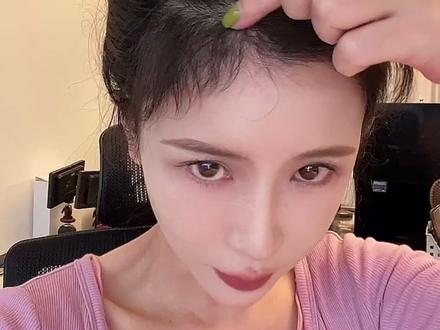 熬过了植发的第四个月,整体还满意 就是后悔植太少了,发际线确实能让脸变小一圈。#发际线 #变美 #时尚百万新星计划