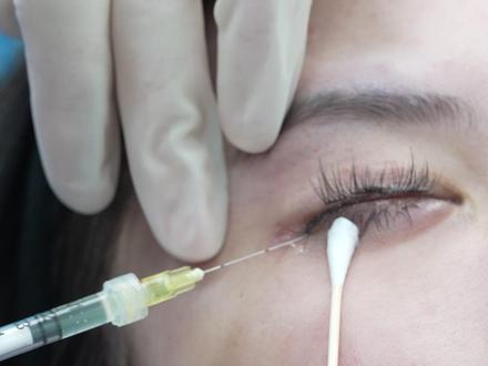 📍武汉 | 第一视角体验,医生注射微调全过程。#第一视角 #武汉注射医生 #武汉注射 #玻尿酸 #邱新宇