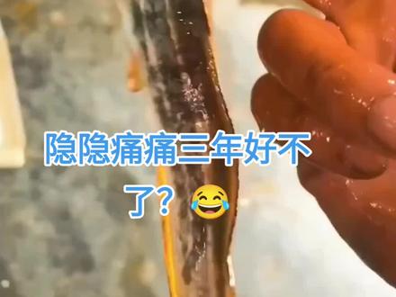 被三毛鱼刺伤一下,隐隐痛痛要三年,那种钻心的痛啊,一般人受不了😂😂#三毛鱼