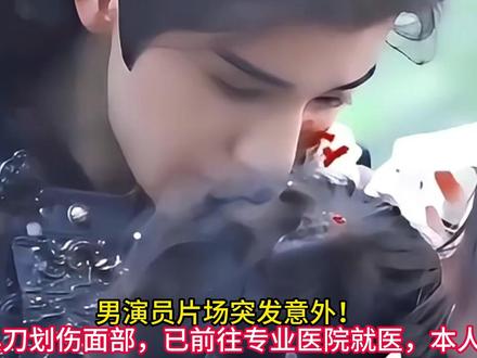 男演员片场突发意外!被道具刀划伤面部,已前往专业医院就医,本 #王弘毅