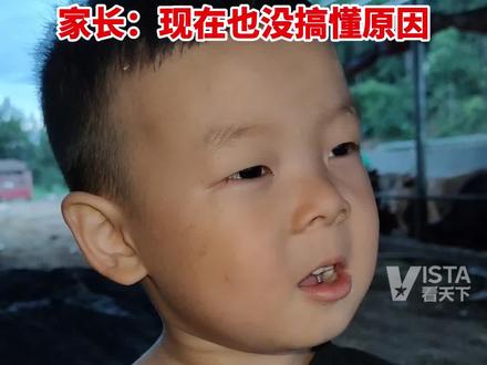 6月22日(采访),湖北恩施。男孩发出“喔”的声音,能召唤一群蚊子聚拢在面前,家长:现在也没搞懂原因。 (来源:@晨禹-刘)