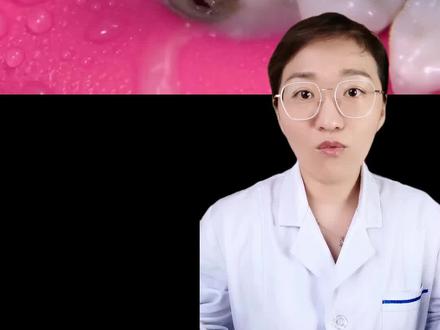 有的人刚补完牙就又疼了,这条视频带你看看正规的修补过程#口腔健康 #根管治疗 #爱护牙齿 ##牙齿健康 #牙医日常 #口腔 #强迫症
