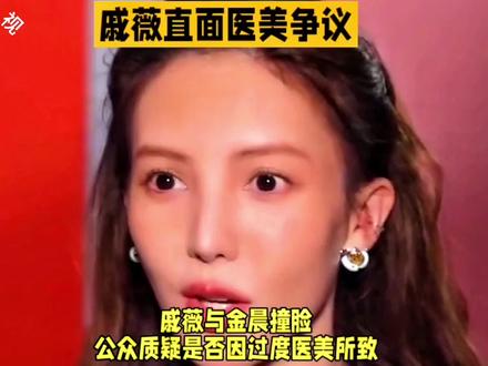 戚薇与金晨撞脸,公众质疑是否因过度医美所致 #上热搜 #娱乐明星资讯 #娱乐圈 #戚薇撞脸金晨