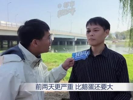 11月7日,河南郑州。残断底座把脚绊,男子眼肿像鹅蛋,全身多处摔伤。