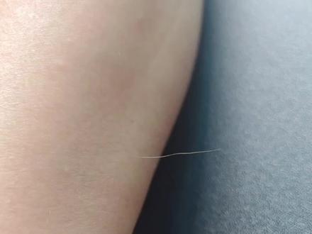 是“福毛”还是“寿毛” 如果身上长了一根长长的白毛可能由色素痣、色素减退性皮肤病或正常现象等因素引起。
#创作者扶持计划