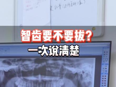 智齿要不要拔?
