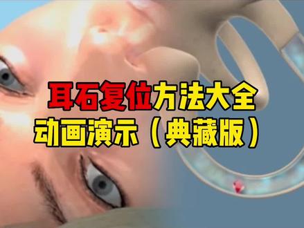 本视频包含了完整的耳石复位方法!
视频素材来自Fauquier ENT,感谢分享,若有侵权,请联系删除。
#医学科普 #眩晕 #耳石症