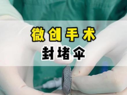 超声引导下的微创封堵手术 #封堵术了解一下 #房缺 #微创手术