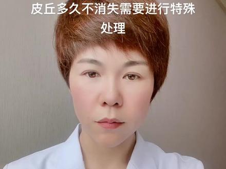 水光针注射后一旦发生过敏、肉芽肿需要及时就诊处理