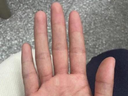 从掌上来看,感情线呈上下两条,有岛纹分叉,感情生活易破裂,家庭方面亦不能很好的顾及,往往会是因为感情不和造成家庭闹不和,平时应多加注意夫妻双方感情的培养。事业线虽有,但是很短,说明你的事业的黄金期短,自己注意抓住机会。