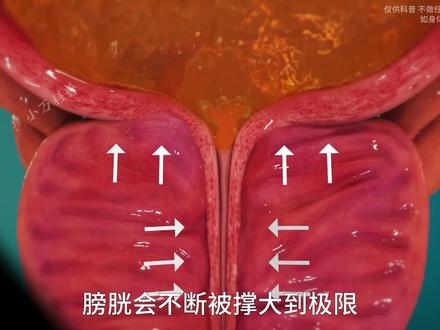 睡前做这两件事,小心肾脏出问题。 #科普 #肾脏 #尿液 #医学科普