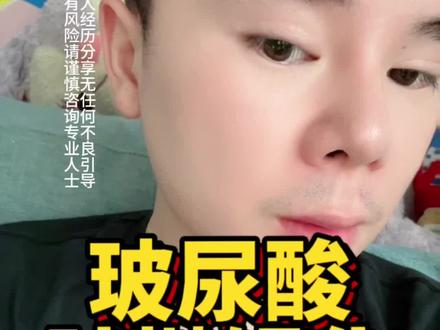 我的额头就是典型的馒化了,有一点肿抛#玻尿酸 #玻尿酸填充 #整容需谨慎