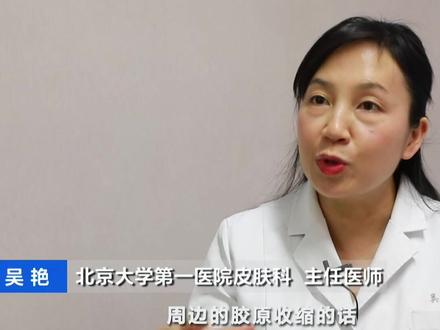 冷热水交替洗脸能收缩毛孔?专家辟谣:不但不对还有可能造成伤害