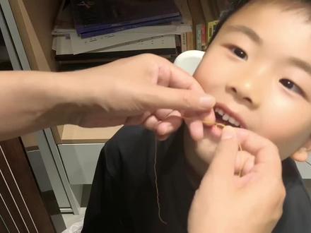 古筝“高手”拔牙事件和拔牙猪鼻扣详细教程 #牙齿🦷 #拔牙 #掉牙的小孩 #拔牙记