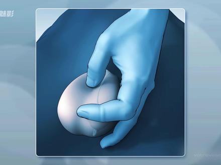 一分钟了解男性结扎与复通全过程! #科普 #科普一下 #男性