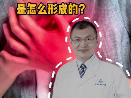 心脏神经官能症是怎么形成的?@心脏科医生张晶 脱口秀 #心脏神经官能症 #抖出健康知识宝藏 #women的健康我们帮 #胸闷胸疼 #焦虑抑郁