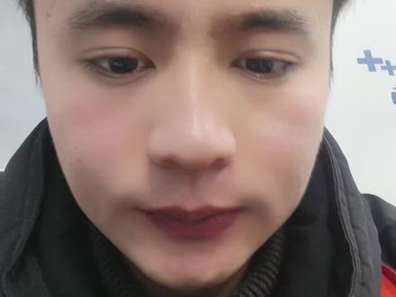 苹果手机摄像头起斑点通病