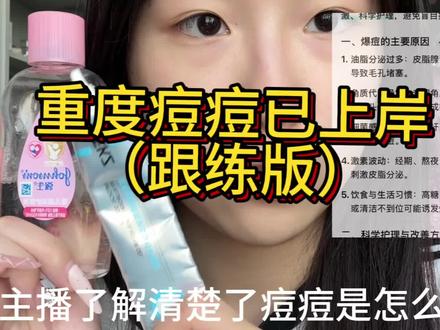 重度痘痘已上岸
#aekz医用凝胶#痘痘#爆痘#痘痘修复