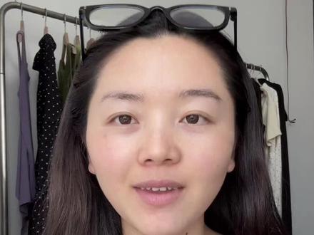 超皮秒结束啦#皮肤问题 #超皮秒 #皮肤 #蜕变 #变美