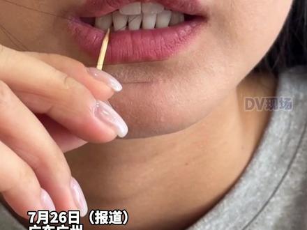 男子叼牙签喝水,误吞牙签致刺穿肠壁插入右肾#广东dou知道